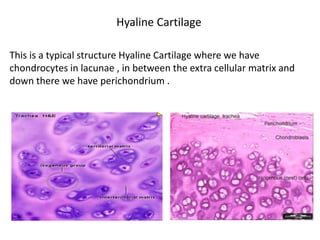 Hyaline Cartilage

This is a typical structure Hyaline Cartilage where we have
chondrocytes in lacunae , in between the extra cellular matrix and
down there we have perichondrium .
 