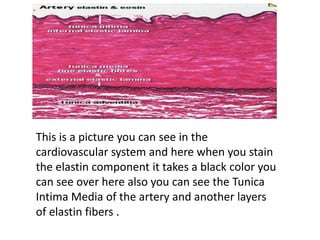 This is a picture you can see in the
cardiovascular system and here when you stain
the elastin component it takes a black color you
can see over here also you can see the Tunica
Intima Media of the artery and another layers
of elastin fibers .
 