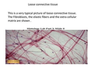 Loose connective tissue

This is a very typical picture of loose connective tissue.
The Fibroblasts, the elastic fibers and the extra cellular
matrix are shown .
 