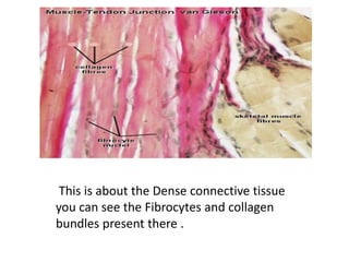 This is about the Dense connective tissue
you can see the Fibrocytes and collagen
bundles present there .
 