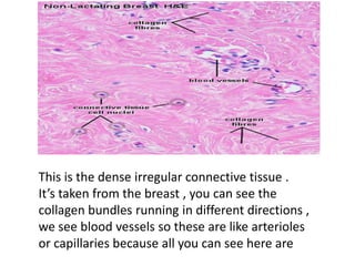 This is the dense irregular connective tissue .
It’s taken from the breast , you can see the
collagen bundles running in different directions ,
we see blood vessels so these are like arterioles
or capillaries because all you can see here are
 