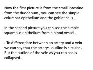Now the first picture is from the small intestine
from the duodenum , you can see the simple
columnar epithelium and the goblet cells .

In the second picture you can see the simple
squamous epithelium from a blood vessel .

- To differentiate between an artery and a vein
we can say that the arterys’ outline is circular .
But the outline of the vein as you can see is
collapsed .
 