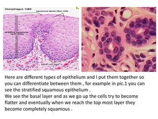 Here are different types of epithelium and I put them together so
you can differentiate between them , for example in pic.1 you can
see the stratified squamous epithelium .
We see the basal layer and as we go up the cells try to become
flatter and eventually when we reach the top most layer they
become completely squamous .
 