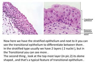 Now here we have the stratified epithelium and next to it you can
see the transitional epithelium to differentiate between them .
In the stratified type usually we have 2 layers ( 2 nuclei ), but in
the Transitional you can see more .
The second thing , look at the top most layer (in pic.2) its dome
shaped , and that’s a typical feature of transitional epithelium .
 