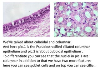 We’ve talked about cuboidal and columnar .
And here pic.1 is the Pseudostratified ciliated columnar
epithelium and pic.2 is about cuboidal epithelium .
To differentiate you can see that the nuclei in pic.1 are
columnar in addition to that we have two more features
here you can see goblet cells and on top you can see cillia .
 