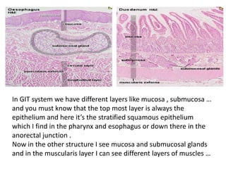 In GIT system we have different layers like mucosa , submucosa …
and you must know that the top most layer is always the
epithelium and here it’s the stratified squamous epithelium
which I find in the pharynx and esophagus or down there in the
anorectal junction .
Now in the other structure I see mucosa and submucosal glands
and in the muscularis layer I can see different layers of muscles …
 