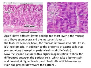 Again I have different layers and the top most layer is the mucosa
also I have submucosa and the muscularis layer …
the features I can see here , the mucosa is thrown into pits like so
it’s the stomach , In addition to the presence of gastric cells that
present along these pits ( parietal cells and chief cells ) .
Now the second picture with a higher magnification to show the
differences between the parietal cells, which take a lighter stain
and present at higher levels.. and chief cells, which takes more
stain and present downward the bottom .
 