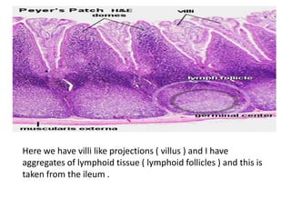 Here we have villi like projections ( villus ) and I have
aggregates of lymphoid tissue ( lymphoid follicles ) and this is
taken from the ileum .
 