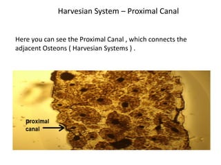 Harvesian System – Proximal Canal


Here you can see the Proximal Canal , which connects the
adjacent Osteons ( Harvesian Systems ) .
 