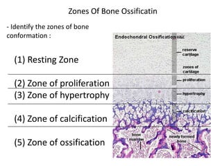 Zones Of Bone Ossificatin
- Identify the zones of bone
conformation :


  (1) Resting Zone

  (2) Zone of proliferation
  (3) Zone of hypertrophy

  (4) Zone of calcification

  (5) Zone of ossification
 