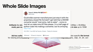 Whole Slide Images
Multi-resolution image (e.g. 5× and 20×)

Pyramidal format
Up to 90,000px × 30,000px

Very large in siz...