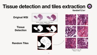 Tissue detection and tiles extraction
Original WSI
Tissue
Detection
Random Tiles
Breast Cancer Sample, TCGA-BRCA
96,972px ...