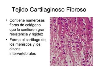 Tejido Cartilaginoso Fibroso
• Contiene numerosas
fibras de colágeno
que le confieren gran
resistencia y rigidez
• Forma el cartílago de
los meniscos y los
discos
intervertebrales
 
