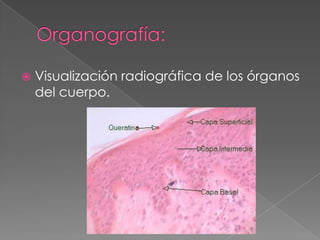  Visualización radiográfica de los órganos
del cuerpo.
 