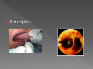  Por cepillo:
 