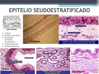 EPITELIO SEUDOESTRATIFICADO
Tráquea
Bronquio
 