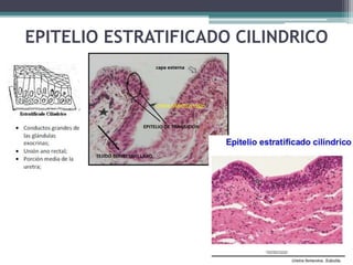 EPITELIO ESTRATIFICADO CILINDRICO
 