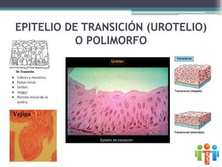 EPITELIO DE TRANSICIÓN (UROTELIO)
O POLIMORFO
Vejiga
 