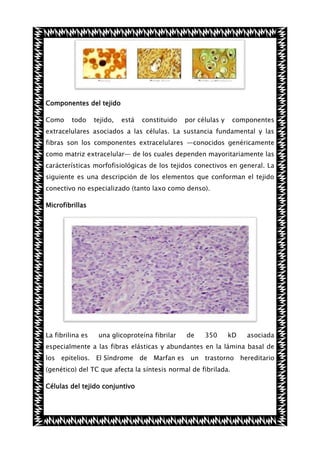 Componentes del tejido
Como

todo

tejido,

está

constituido

por células y

componentes

extracelulares asociados a las células. La sustancia fundamental y las
fibras son los componentes extracelulares —conocidos genéricamente
como matriz extracelular— de los cuales dependen mayoritariamente las
carácterísticas morfofisiológicas de los tejidos conectivos en general. La
siguiente es una descripción de los elementos que conforman el tejido
conectivo no especializado (tanto laxo como denso).
Microfibrillas

La fibrilina es

una glicoproteína fibrilar

de

350

kD

asociada

especialmente a las fibras elásticas y abundantes en la lámina basal de
los epitelios. El Síndrome de Marfan es un trastorno hereditario
(genético) del TC que afecta la síntesis normal de fibrilada.
Células del tejido conjuntivo

 