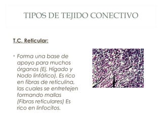 TIPOS DE TEJIDO CONECTIVO
T.C. Reticular:
• Forma una base de
apoyo para muchos
órganos (Ej. Hígado y
Nodo linfático). Es rico
en fibras de reticulina,
las cuales se entretejen
formando mallas
(Fibras reticulares) Es
rico en linfocitos.
 