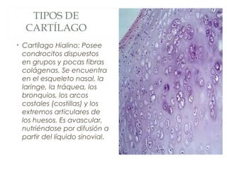 TIPOS DE
CARTÍLAGO
• Cartílago Hialino: Posee
condrocitos dispuestos
en grupos y pocas fibras
colágenas. Se encuentra
en el esqueleto nasal, la
laringe, la tráquea, los
bronquios, los arcos
costales (costillas) y los
extremos articulares de
los huesos. Es avascular,
nutriéndose por difusión a
partir del líquido sinovial.
 