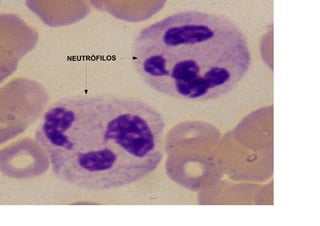 NEUTRÓFILOS
 