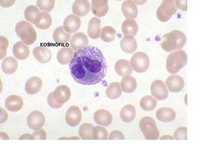 EOSINÓFILO
 