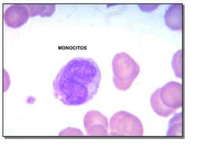MONOCITOS
 