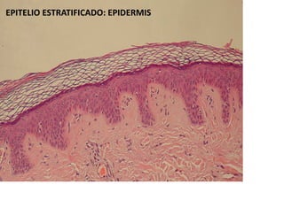 EPITELIO ESTRATIFICADO: EPIDERMIS
 