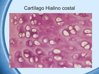 Cartílago Hialino costal 
 