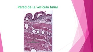 Pared de la vesícula biliar
 