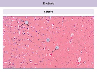 Encéfalo
Cerebro

G

S

C

 