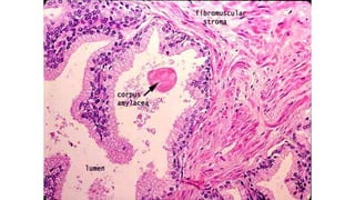 Histología RENAL
