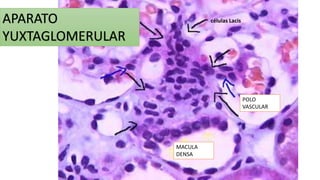 APARATO 
YUXTAGLOMERULAR 
MACULA 
DENSA 
POLO 
VASCULAR 
células Lacis 
 