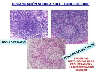 EVIDENCIAS
HISTOLÓGICAS DE LA
PROLIFERACIÓN Y
LA DIFERENCIACIÓN
CELULAR
NÓDULO PRIMARIO
ORGANIZACIÓN NODULAR DEL TEJIDO LINFOIDE
 