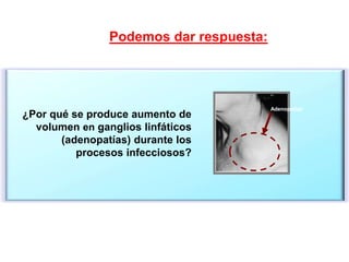 Adenopatías
¿Por qué se produce aumento de
volumen en ganglios linfáticos
(adenopatías) durante los
procesos infecciosos?
Podemos dar respuesta:
 