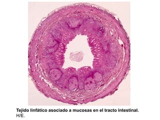 Tejido linfático asociado a mucosas en el tracto intestinal.
H/E.
 