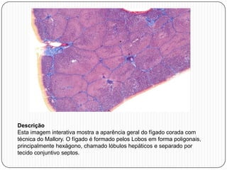 Descrição
Esta imagem interativa mostra a aparência geral do fígado corada com
técnica do Mallory. O fígado é formado pelos Lobos em forma poligonais,
principalmente hexágono, chamado lóbulos hepáticos e separado por
tecido conjuntivo septos.
 