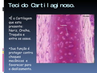 Tecido Cartilaginoso. É a Cartilagem que esta presente: Nariz, Orelha, Traquéia e entre os ossos. Sua função é proteger contra choques mecânicos  e favorecer para o deslizamento. 
