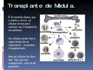 Transplante de Mêdula. É na medula óssea, que  o médico retira  as células novas para realizar um transplante, em pessoas . As células novas tem a capacidade de se reproduzir , na pessoa transplantada. Mas as células do doar dor  tem que ser compatíveis  com as do paciente. 