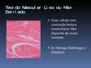 Tecido Muscular Liso ou Não-Estriado Suas  células tem contração lenta e involuntária. Não depende da nossa vontade. Ex: Bexiga, Estômago e Intestino. 