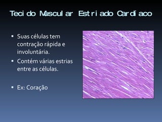 Tecido Muscular Estriado Cardíaco Suas células tem contração rápida e involuntária. Contém várias estrias entre as células. Ex: Coração 