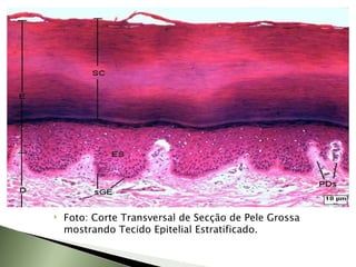 Foto: Corte Transversal de Secção de Pele Grossa mostrando Tecido Epitelial Estratificado.  