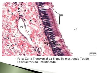 Foto: Corte Transversal da Traquéia mostrando Tecido Epitelial Pseudo-Estratificado. 