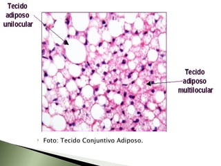 Foto: Tecido Conjuntivo Adiposo. 