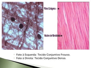 Foto à Esquerda: Tecido Conjuntivo Frouxo. Foto à Direita: Tecido Conjuntivo Denso. 