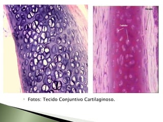 Fotos: Tecido Conjuntivo Cartilaginoso. 