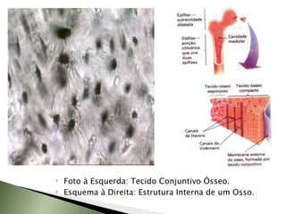Foto à Esquerda: Tecido Conjuntivo Ósseo. Esquema à Direita: Estrutura Interna de um Osso. 