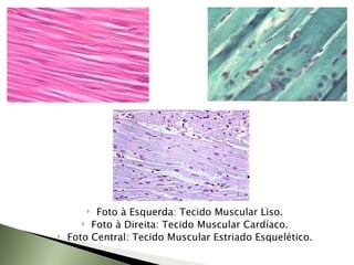 Foto à Esquerda: Tecido Muscular Liso. Foto à Direita: Tecido Muscular Cardíaco. Foto Central: Tecido Muscular Estriado Esquelético. 