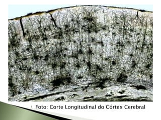 Foto: Corte Longitudinal do Córtex Cerebral 
